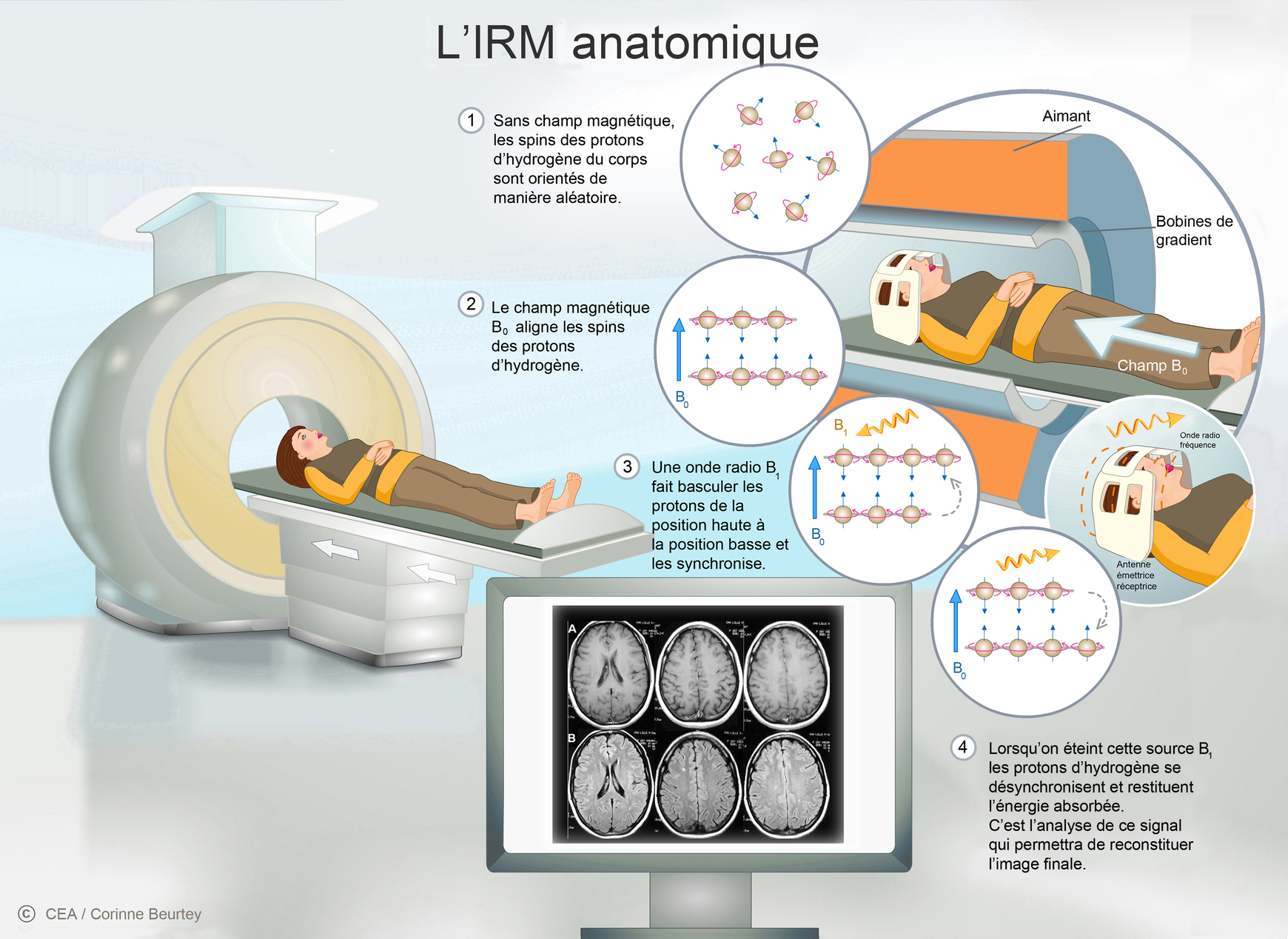 MRI